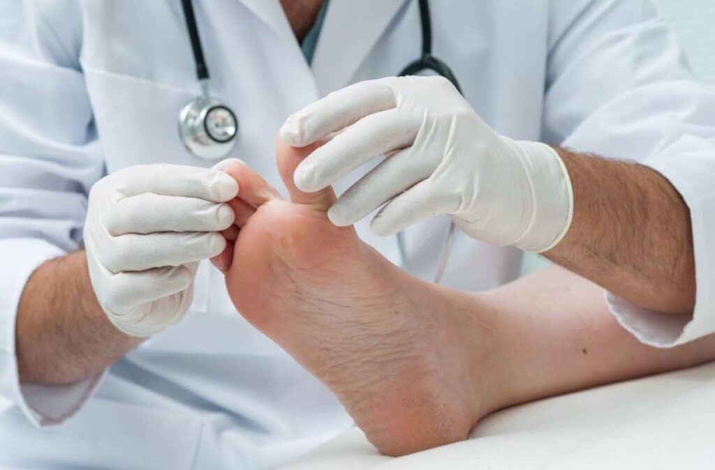 Who Is a Good Corn Removal Candidate